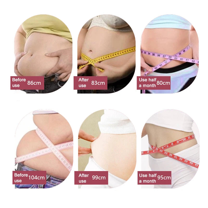 Lilvigor Girdles Shapewear