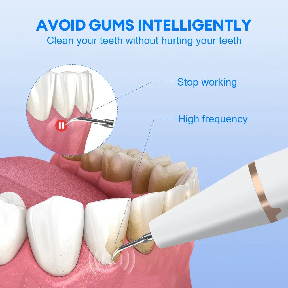 Ultrasonic Water Flosser Teeth Cleaner